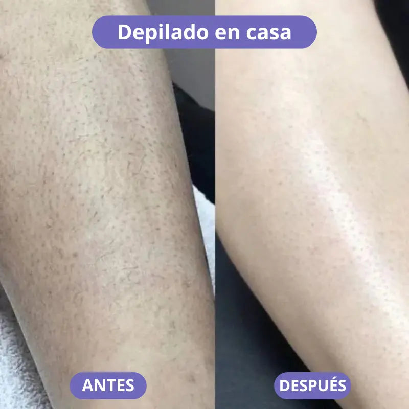 Depiladora de Cristal Mineva®️