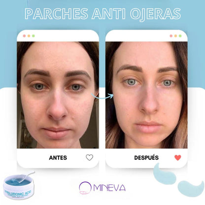 Vitalift®️ - Rejuvenece tu rostro (60 Unidades)